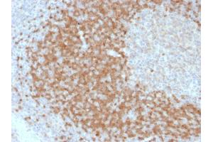 Immunohistochemistry (IHC) image for anti-T-Cell Leukemia/lymphoma 1A (TCL1A) (AA 2-109) antibody (ABIN6940948)
