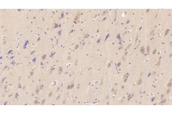 NT-ProBNP antibody