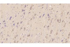 Detection of NT-ProBNP in Human Cerebrum Tissue using Monoclonal Antibody to N-Terminal Pro-Brain Natriuretic Peptide (NT-ProBNP)