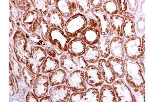 IHC-P Image ACAT1 antibody [N1N3] detects ACAT1 protein at cytoplasm on human normal kidney by immunohistochemical analysis. (ACAT1 antibody  (N-Term))