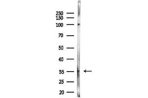 Western blot analysis of lysates from F10-LUC cells(heat-shock,45 min treatment), using OR52J3 Antibody at 1/1000 dilution.
