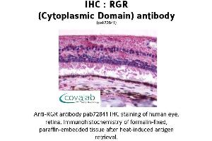 Image no. 1 for anti-Retinal G Protein Coupled Receptor (RGR) (3rd Cytoplasmic Domain) antibody (ABIN1738848)