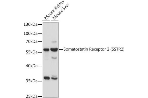 SSTR2 antibody  (C-Term)