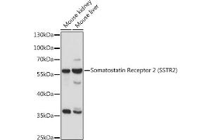 SSTR2 antibody  (C-Term)