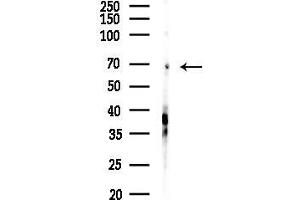 anti-Solute Carrier Family 6 (Neurotransmitter Transporter, Betaine/GABA), Member 12 (SLC6A12) (C-Term) antibody