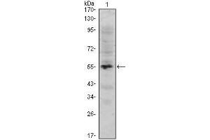 Western Blot showing MUM1 antibody used against human MUM1 (AA: 590-711) recombinant protein.