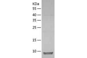 Western Blotting (WB) image for Agouti Related Protein Homolog (Mouse) (AGRP) (AA 21-132) protein (His tag) (ABIN7284234) (AGRP Protein (AA 21-132) (His tag))