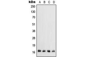 Western blot analysis of TGF alpha expression in HEK293T (A), mouse liver (B), mouse kidney (C), rat kidney (D) whole cell lysates. (TGFA antibody  (C-Term))