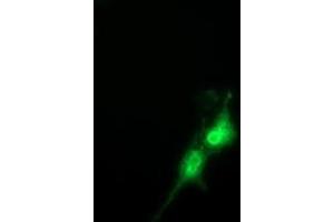 Anti-FAM84B mouse monoclonal antibody (ABIN2453031) immunofluorescent staining of COS7 cells transiently transfected by pCMV6-ENTRY FAM84B (RC207996). (FAM84B antibody)