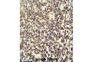 Immunohistochemistry (IHC) image for anti-PARP1 Binding Protein (PARPBP) antibody (ABIN2995516) (PARPBP antibody)