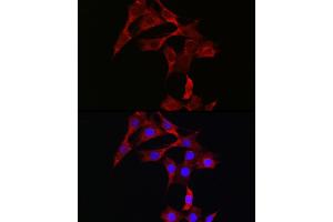 Immunofluorescence analysis of NIH/3T3 cells using [KO Validated] ST Rabbit mAb (ABIN7270305) at dilution of 1:100 (40x lens).
