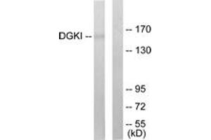 Western blot analysis of extracts from 293 cells, using DGKI Antibody. (DGKI antibody  (AA 991-1040))