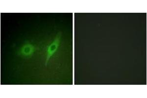 Immunofluorescence analysis of HeLa cells, using Collagen IV alpha2 Antibody. (COL4a2 antibody  (AA 151-200))