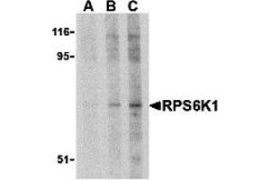 Western Blotting (WB) image for anti-RPS6K1 (C-Term) antibody (ABIN1030629) (RPS6K1 (C-Term) antibody)