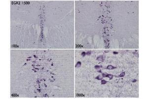 IHC-Fr Image Immunohistochemical analysis of mouse brain tissue (paraformaldehyde-fixed frozen sections), using EGR2, antibody at 1:500 dilution. (EGR2 antibody)