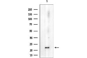 Western blot analysis of lysates from Mouse brain, using Peroxiredoxin 1 Mouse Monoclonal Antibody at 1/1000 dilution.