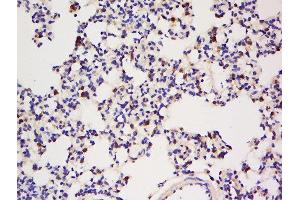 Formalin-fixed and paraffin embedded rat lung tissue labeled with Anti-IGBP1 Polyclonal Antibody, Unconjugated  at 1:200 followed by conjugation to the secondary antibody and DAB staining. (IGBP1 antibody  (AA 151-250))