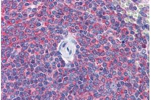 Human Spleen: Formalin-Fixed, Paraffin-Embedded (FFPE) (SNAPIN antibody  (AA 41-137))