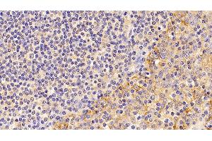 Detection of ATP1a1 in Human amygdalitis Tissue using Monoclonal Antibody to ATPase, Na+/K+ Transporting Alpha 1 Polypeptide (ATP1a1) (ATP1A1 antibody  (AA 493-660))