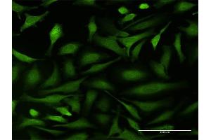 Immunofluorescence of purified MaxPab antibody to BCAR1 on HeLa cell. (BCAR1 antibody  (AA 1-870))