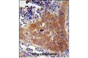 Immunohistochemistry (Paraffin-embedded Sections) (IHC (p)) image for anti-F-Box and WD Repeat Domain Containing 8 (FBXW8) (AA 270-299) antibody (ABIN654676)