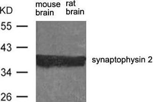 Western blot analysis of extract from rat brain and mouse brain using synaptophysin 2 Antibody. (Synaptoporin antibody)
