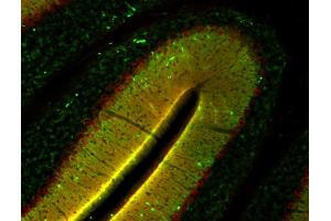 Indirect immunolabeling of mouse cerebellum section with anti-homer 3 (dilution 1 : 500; red) and anti-synapsin (, dilution 1 : 500; green). (HOMER3 antibody  (AA 1-177))
