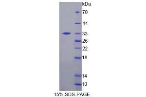 SDS-PAGE (SDS) image for 2',3'-Cyclic Nucleotide 3' phosphodiesterase (CNP) (AA 110-365) protein (His tag) (ABIN4989112) (Cnpase Protein (AA 110-365) (His tag))