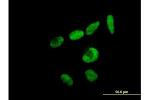 Immunofluorescence of purified MaxPab antibody to RBM15 on HeLa cell. (RBM15 antibody  (AA 1-544))
