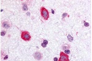 Anti-GALR3 antibody  ABIN1048648 IHC staining of rat brain, hippocampus. (GALR3 antibody  (Cytoplasmic Domain))