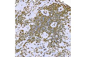 IHC analysis of Histone H1. (Histone H1 antibody  (AA 20-159))