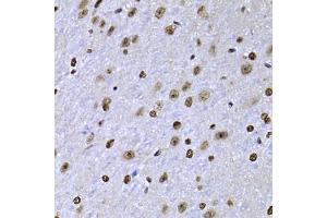 Immunohistochemistry of paraffin-embedded mouse brain using SOX5 antibody (ABIN5974201) at dilution of 1/100 (40x lens). (SOX5 antibody)