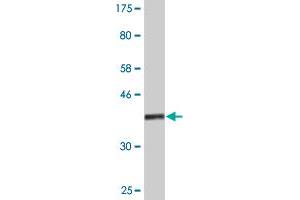 Western Blot detection against Immunogen (37. (ASH2L antibody  (AA 424-530))