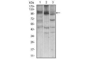 Western blot analysis using NBN mouse mAb against A549 (1), Jurkat (2) and PC-12 (3) cell lysate. (Nibrin antibody  (AA 467-615))
