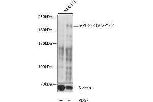 Western blot analysis of extracts of NIH/3T3 cells, using Phospho-PDGFRB-Y751 antibody (ABIN7269397) at 1:1000 dilution. (PDGFRB antibody  (pTyr751))
