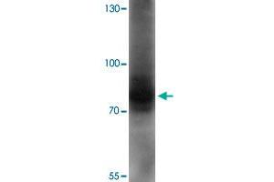 Western blot analysis of AFAP1L1 in A-549 cell lysate with AFAP1L1 polyclonal antibody  at 1 ug/mL. (AFAP1L1 antibody  (N-Term))