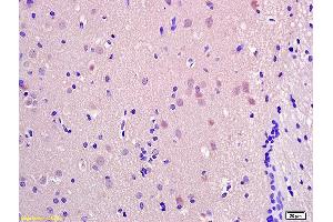 Formalin-fixed and paraffin embedded rat brain labeled with Anti-SRRM2 Polyclonal Antibody, Unconjugated (ABIN873267) at 1:200 followed by conjugation to the secondary antibody and DAB staining.