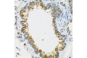 Immunohistochemistry of paraffin-embedded rat lung using PI3 antibody (ABIN6293676) at dilution of 1:100 (40x lens). (PI3 antibody)