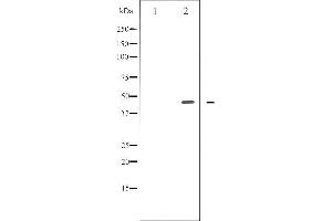 Western blot analysis of E2F1 phosphorylation expression in Etoposide treated HeLa whole cell lysates,The lane on the left is treated with the antigen-specific peptide. (E2F1 antibody  (pThr433))