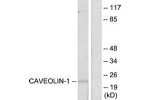 Western blot analysis of extracts from NIH-3T3 cells, using Caveolin-1 (Ab-14) Antibody. (Caveolin-1 antibody  (AA 5-54))