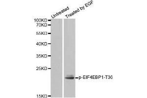 Western blot analysis of extracts from MDA-MB-435 cells, using Phospho-EIF4EBP1-T36 antibody. (eIF4EBP1 antibody  (pThr36))