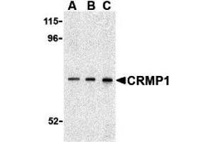 Western Blotting (WB) image for anti-Collapsin Response Mediator Protein 1 (CRMP1) (C-Term) antibody (ABIN1030345) (CRMP1 antibody  (C-Term))
