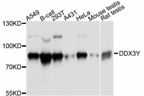 DDX3Y antibody  (AA 1-210)