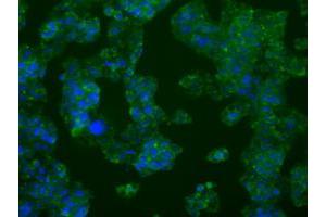 Anti-PFKFB4 mouse monoclonal antibody (ABIN2453452) immunofluorescent staining of COS7 cells transiently transfected by pCMV6-ENTRY PFKFB4 (RC201573). (PFKFB4 antibody)