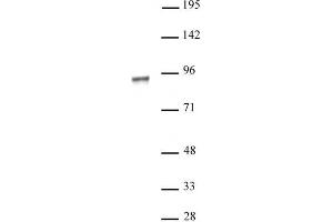 NR3C1 antibody (pAb) tested by Western blot. (Glucocorticoid Receptor antibody)