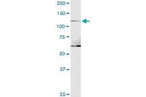 ITGA1 MaxPab polyclonal antibody. (Integrin alpha 1 antibody  (AA 1-1179))