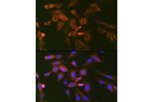 Immunofluorescence analysis of NIH-3T3 cells using Ube2N/Ubc13 Rabbit mAb (ABIN7271179) at dilution of 1:100 (40x lens). (UBE2N antibody)
