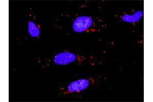 Proximity Ligation Analysis of protein-protein interactions between TRAF2 and ZBTB16. (ZBTB16 antibody  (AA 381-480))