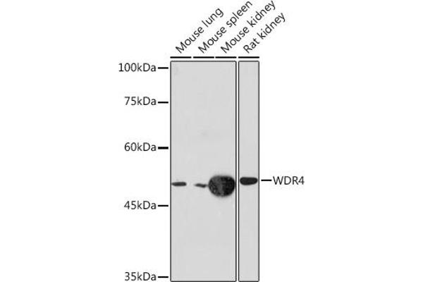 WDR4 抗体