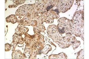 Immunohistochemistry (IHC) image for anti-Tumor Necrosis Factor Receptor Superfamily, Member 14 (TNFRSF14) (AA 37-202) antibody (ABIN1983235)